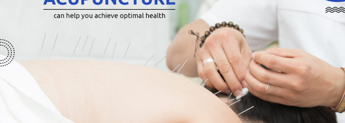 7 Ways how acupuncture can help you achieve optimal health