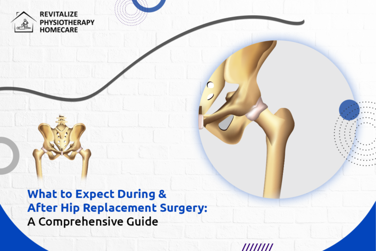 What to Expect During & After Hip Replacement Surgery A Comprehensive