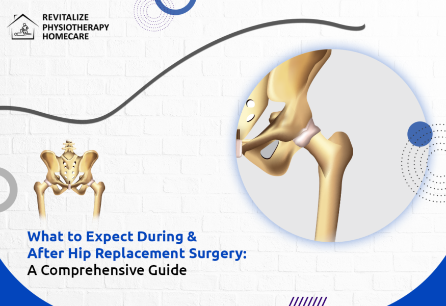 What to Expect During & After Hip Replacement Surgery: A Comprehensive Guide