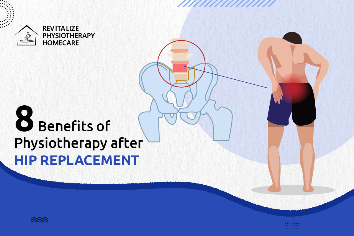 8 Benefits of Physio after Hip Surgery