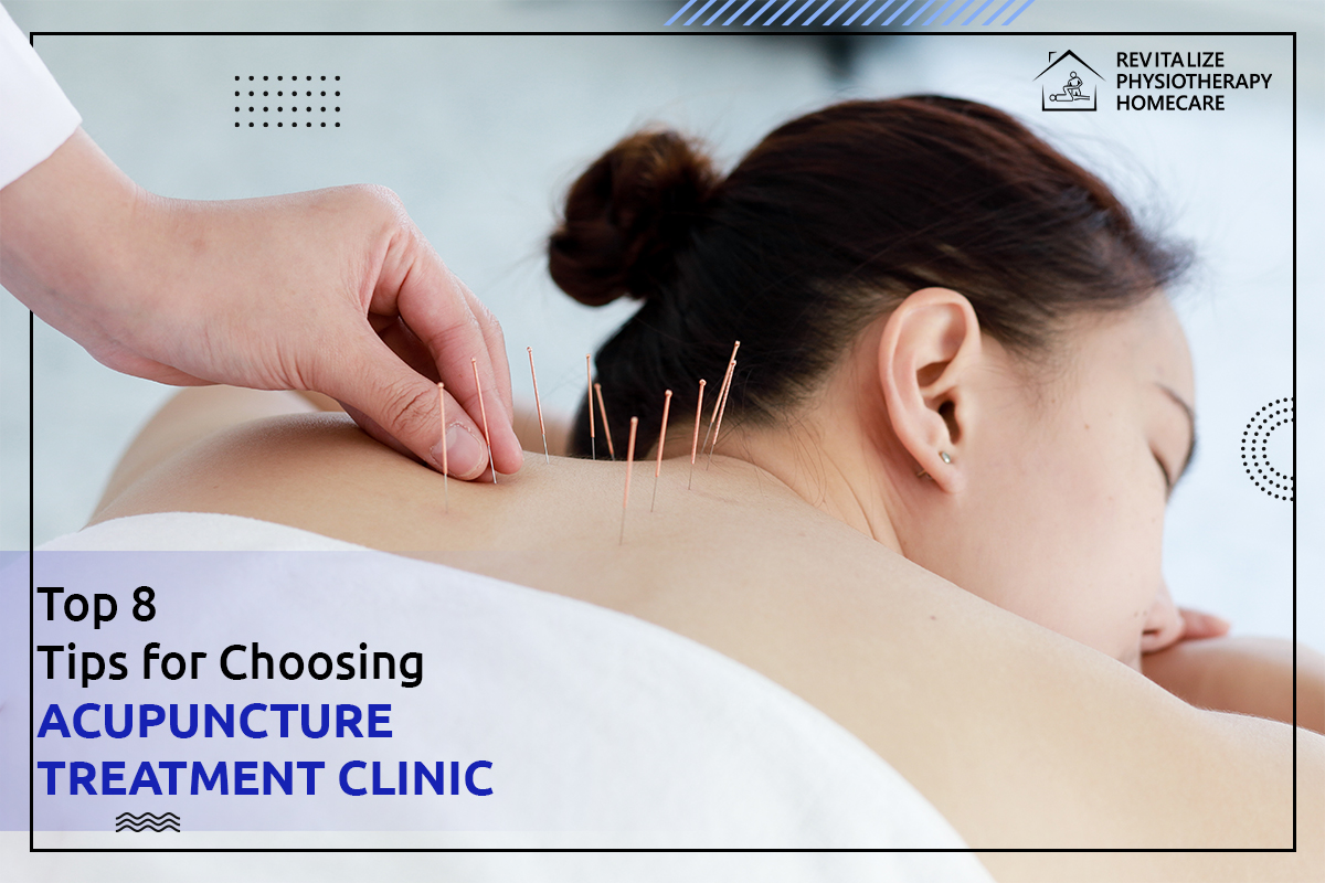 Top 8 Tips for Choosing Acupuncture Treatment Clinic