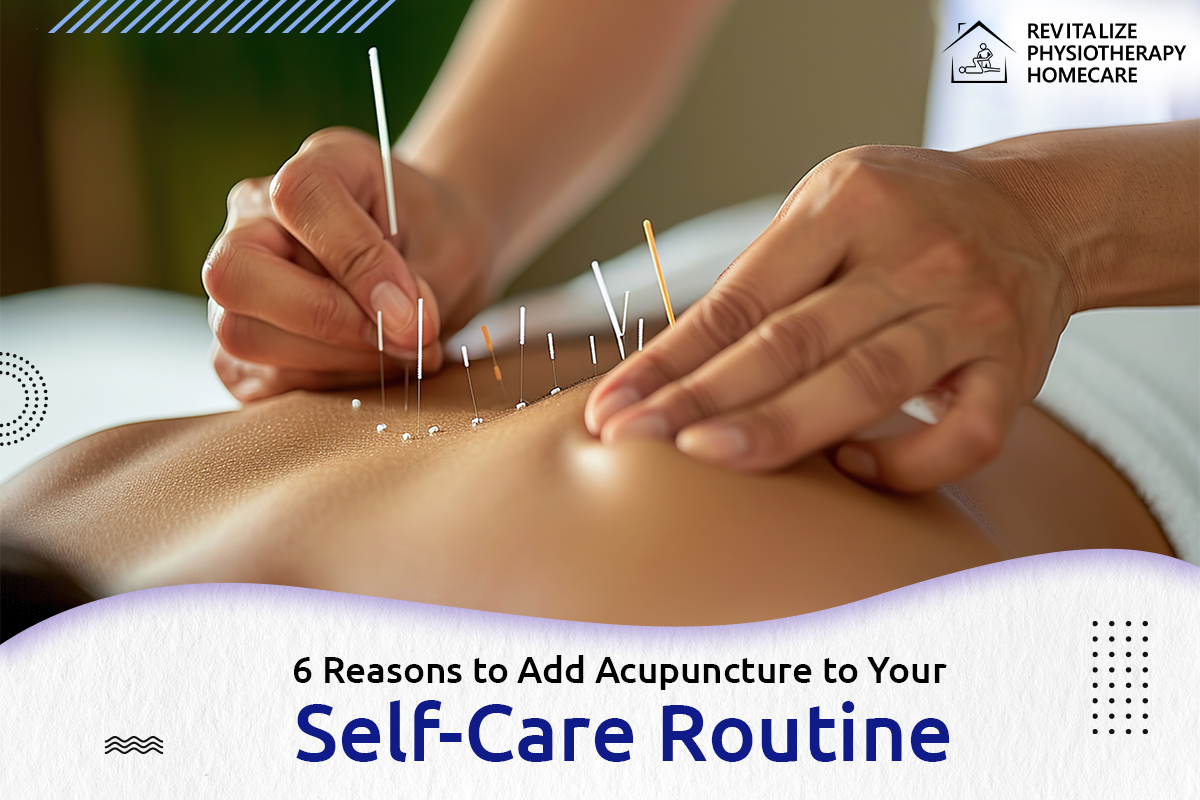 6 Reasons to Add Acupuncture to Your Self-Care Routine
