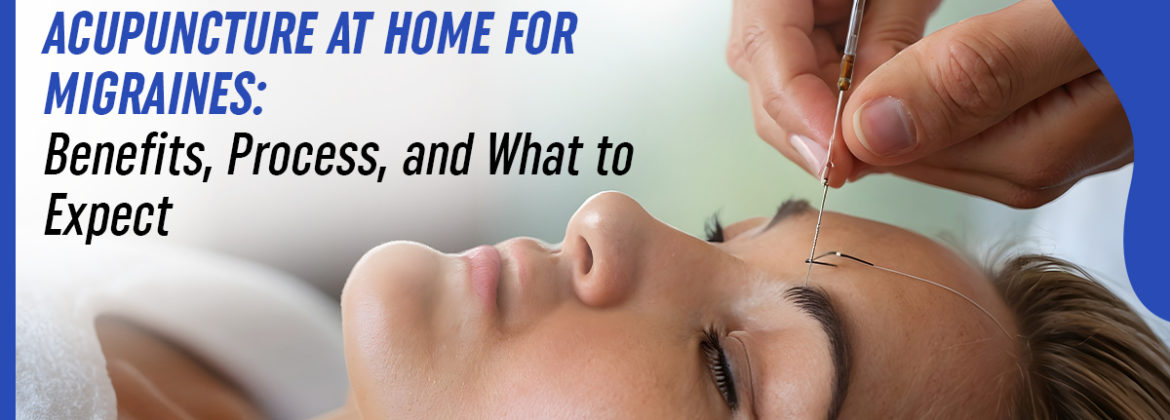 acupuncture-at-home-for-migraines