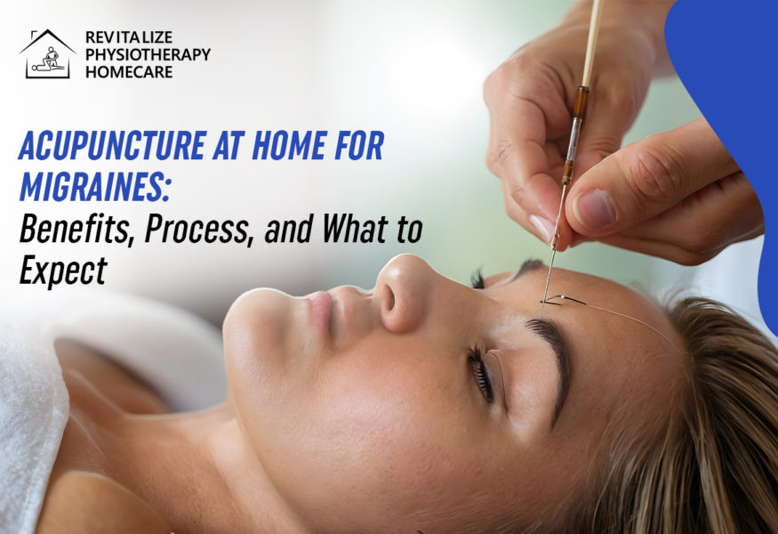 Acupuncture at home for Migraines: Benefits, Process, and What to Expect